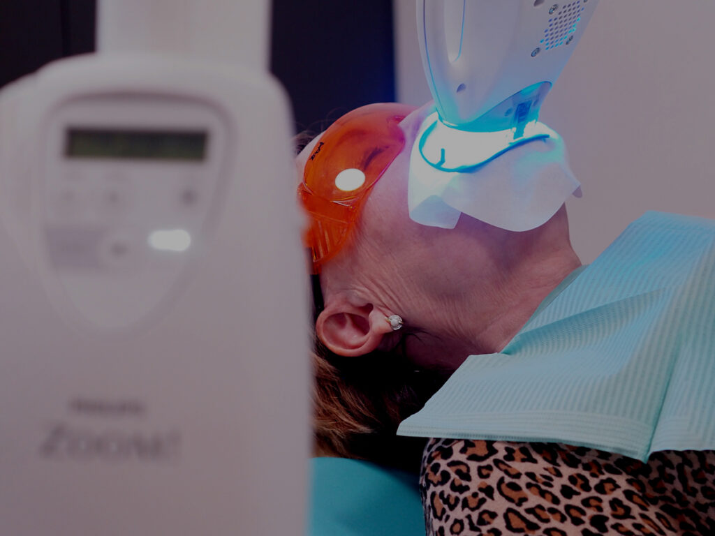 blanqueamiento-dental-madrid